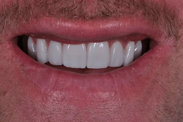 smiledesign_nachher_2.png 
