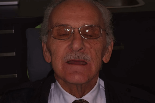 zahnimplantate_vorhher.png 