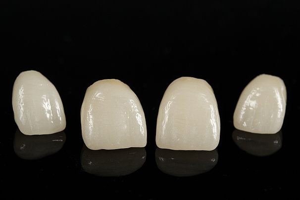 Veneers.jpg