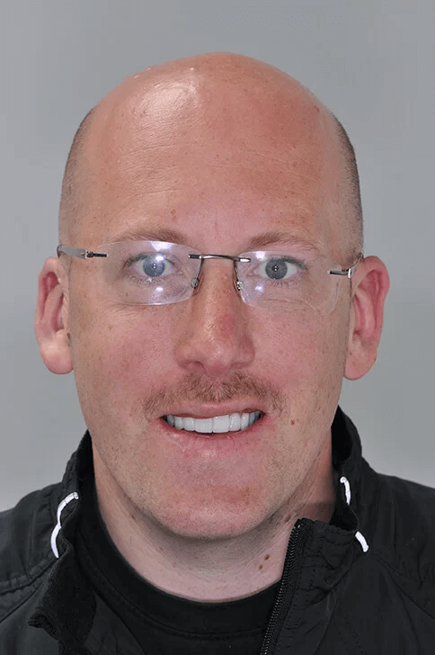 smiledesign_nachher.png 